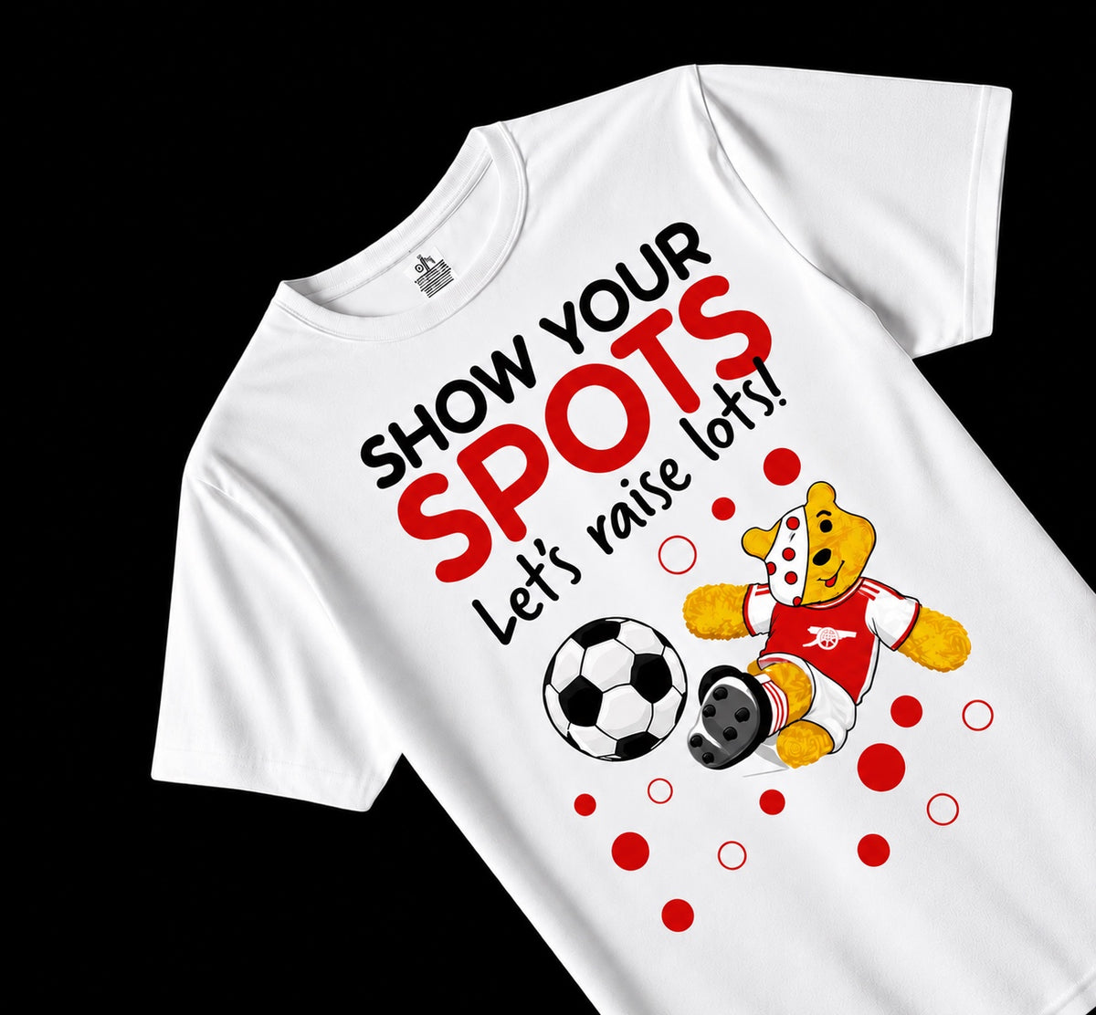 Children In Need Show Your Spots – Arsenal Football